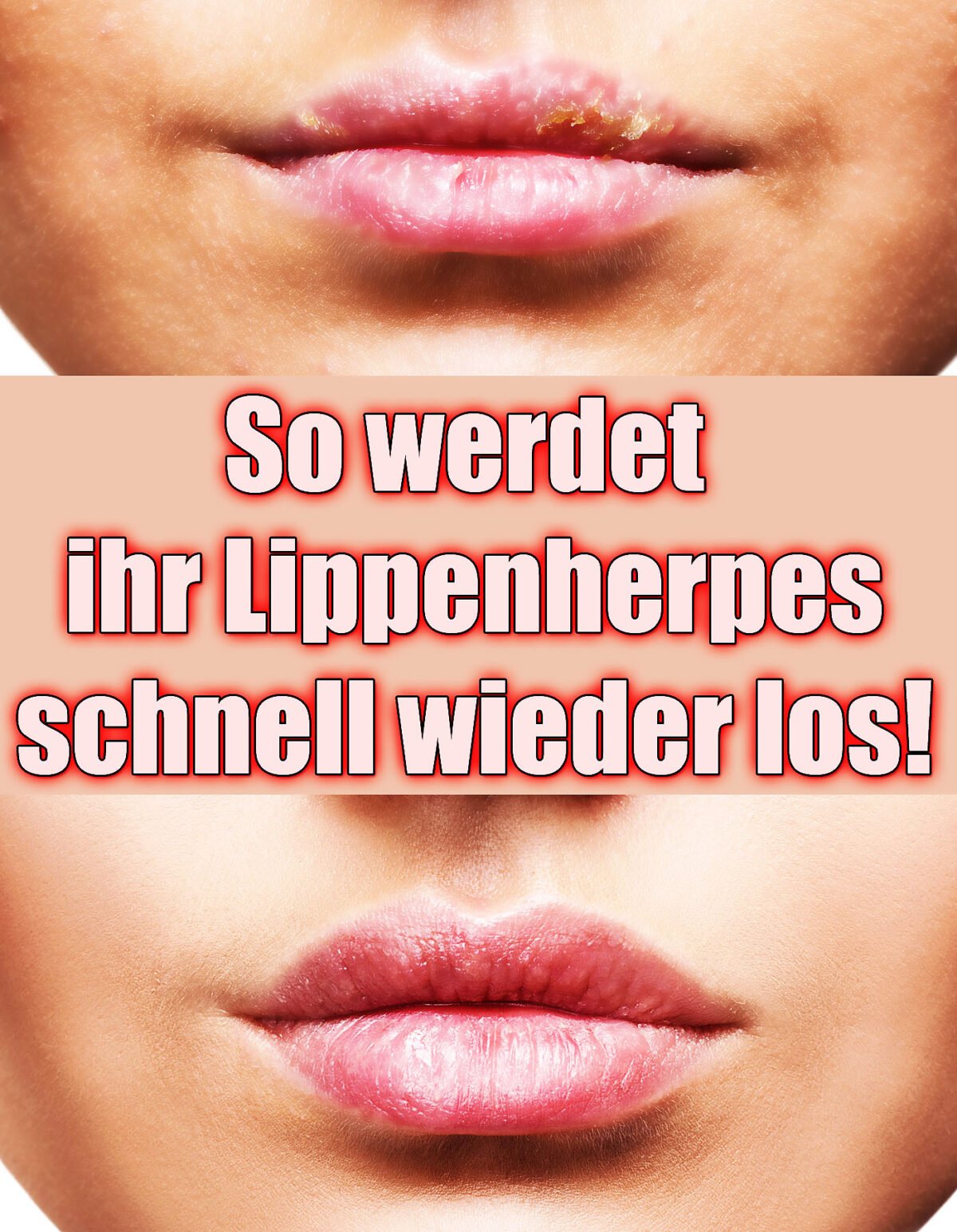 Lippenherpes schnell loswerden – Tipps mit denen es garantiert klappt